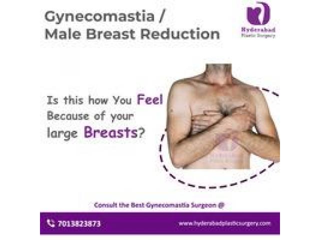 Best Gynecomastia Surgery in Hyderabad - 1